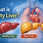 What is fatty liver