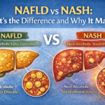 NAFLD vs NASH