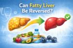 reverse fatty liver disease