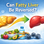 reverse fatty liver disease