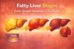 Fatty liver stages