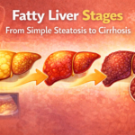 Fatty liver stages